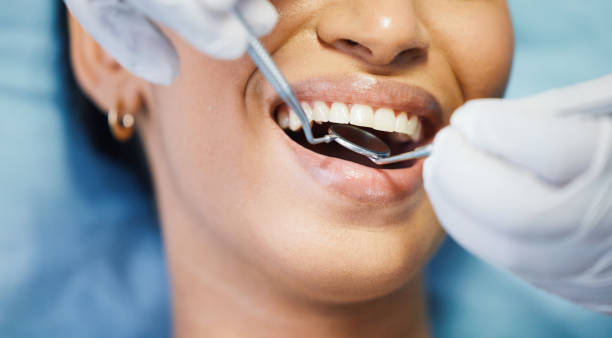 Best Emergency Treatment for Oral Infections in Lochearn, MD
